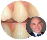 icona corso zucchelli_150_